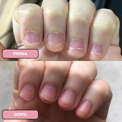 Penna per Crescita Unghie alle Cellule Staminali